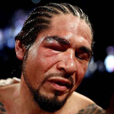 Cotto destruye el ojo de Margarito y paran la pelea