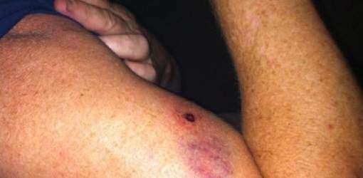 Club de tiro ‘estaba cerrado’ el día del ‘car-jacking’ de Casellas