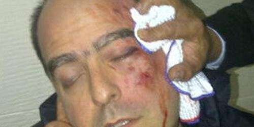 Diputados opositores vuelven a ser agredidos en el Parlamento venezolano