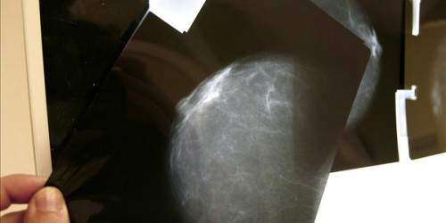 Estudios apuntan a descartar la mamografía a temprana edad