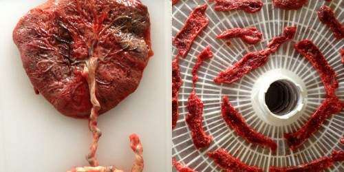 #NotiSalud – La ciencia no puede probar los beneficios de la ingesta de pla