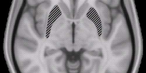 Cómo la pornografía afecta la estructura y el funcionamiento cerebral