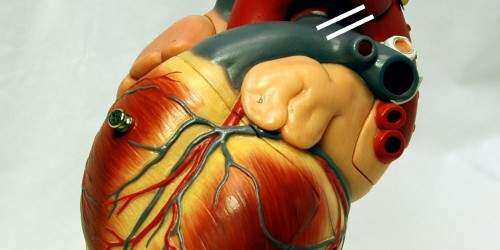 #NotiSalud: No más excusas para comenzar a mejorar tu salud cardiovascular