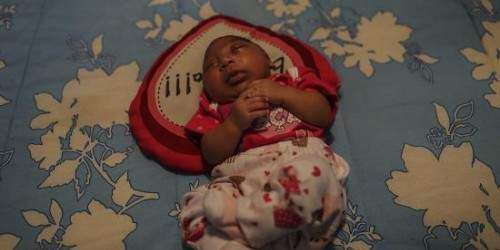 Madre brasileña: Es viable cuidar a un niño con microcefalia (vídeo)