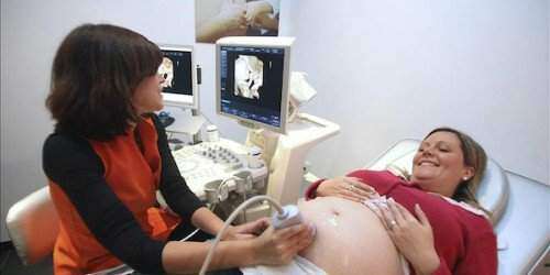 Menos nacimientos prematuros en Puerto Rico