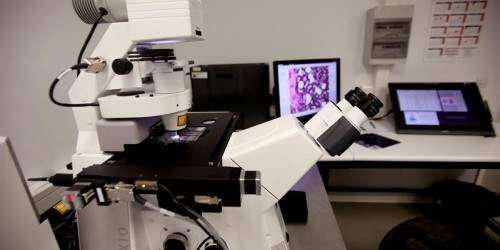 Descubren células que permiten reducir tumores