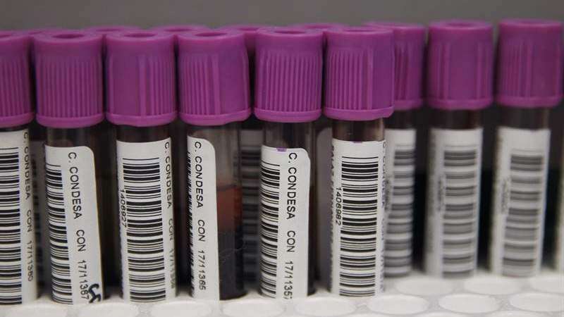 En Latinoamérica una de cada tres personas con VIH no lo sabe