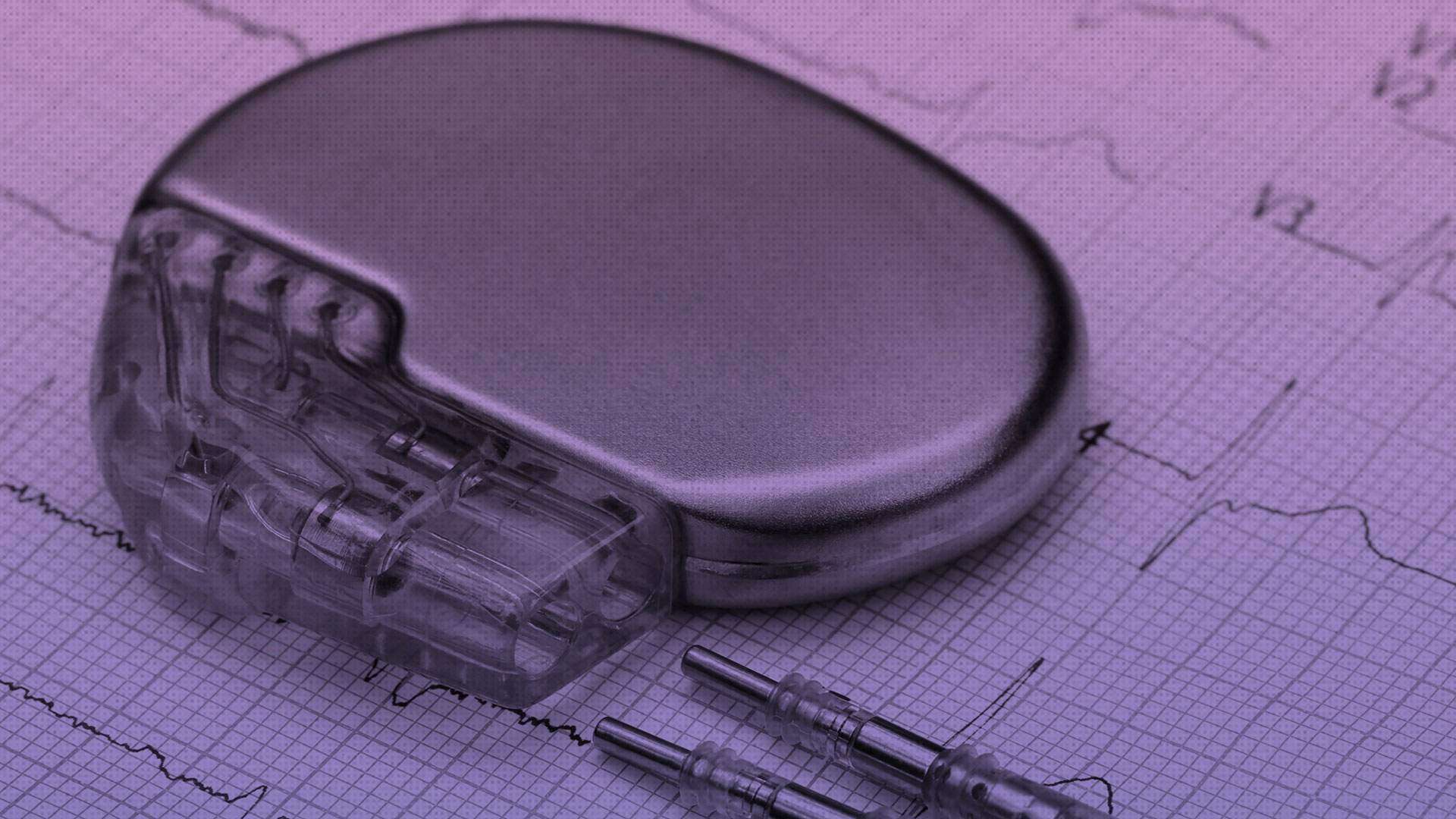 Alertan de problemas con baterías de ciertos marcapasos