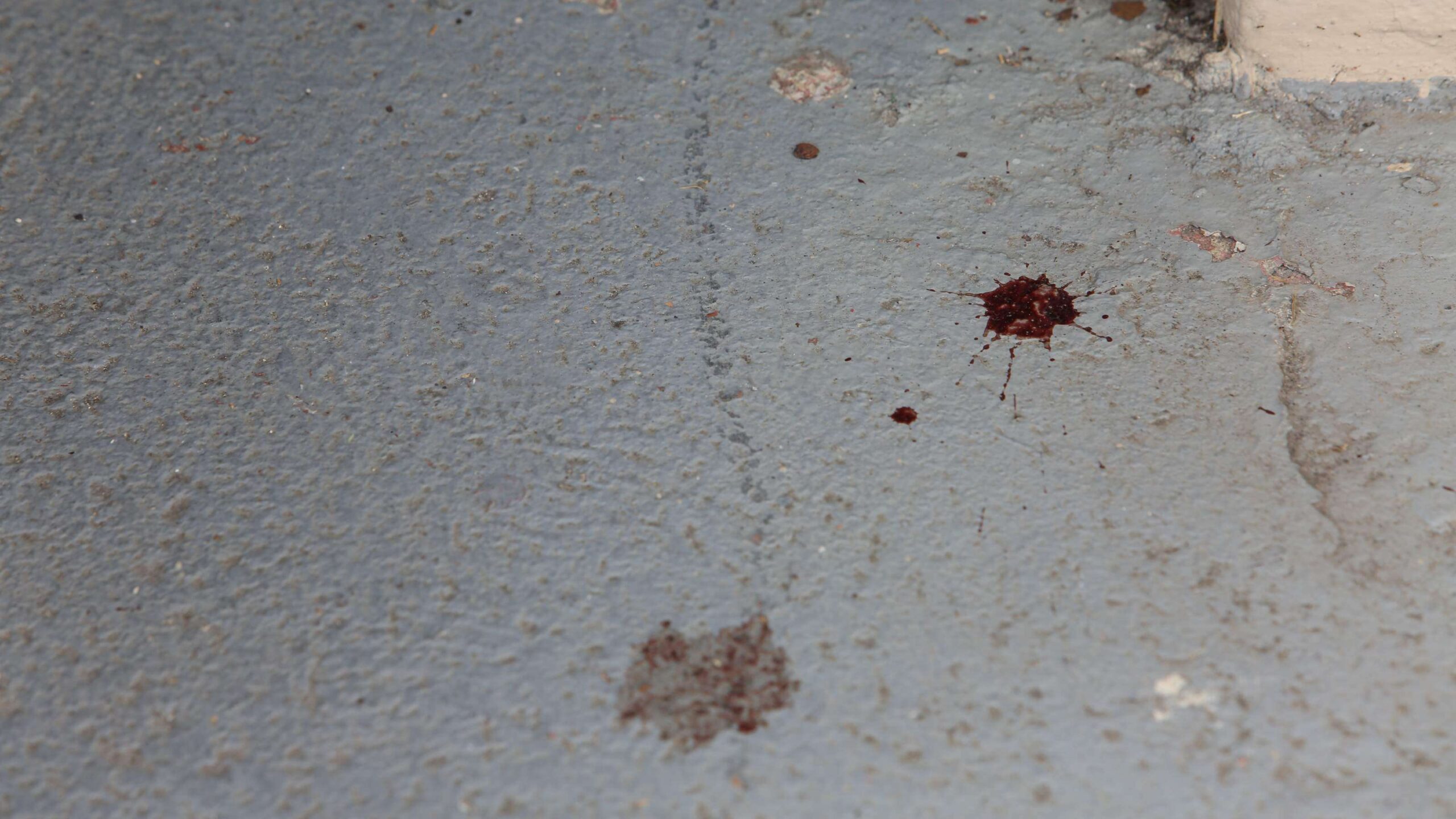 Recibe una herida de bala en la cadera mientras conducía