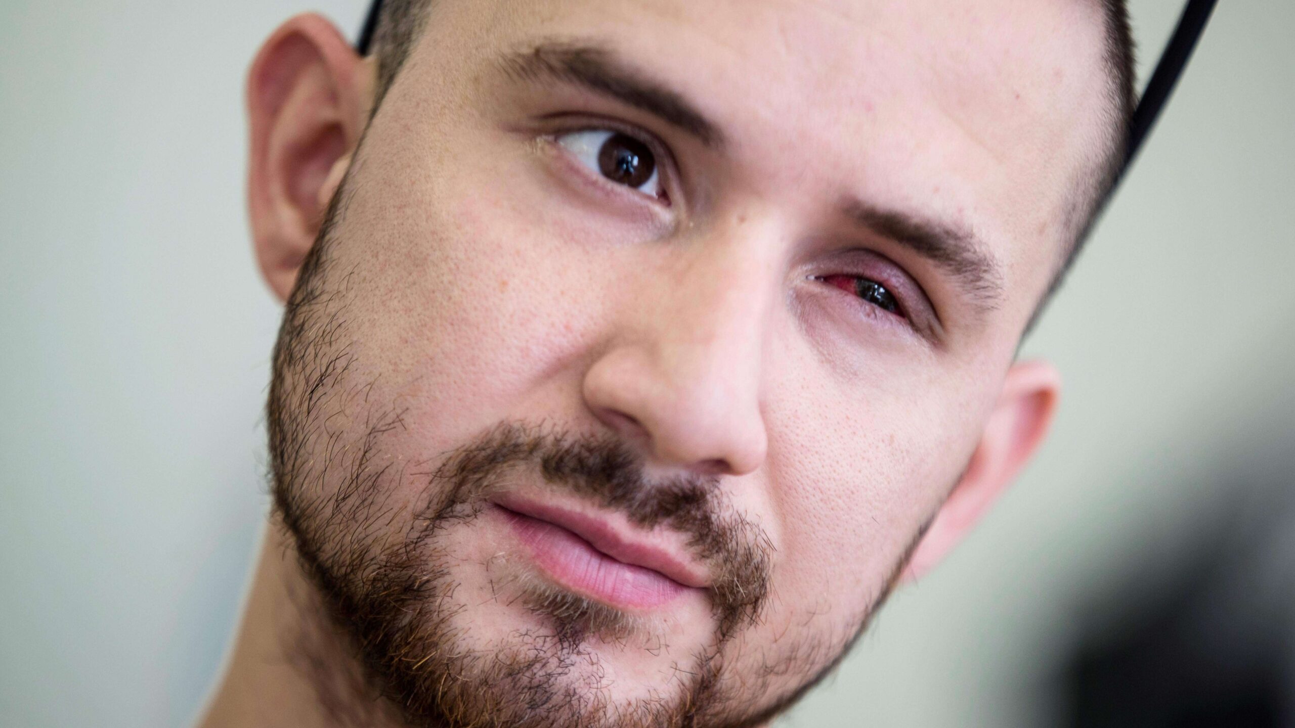 Tiros a los ojos, la estrategia de Chile para aplacar a manifestantes