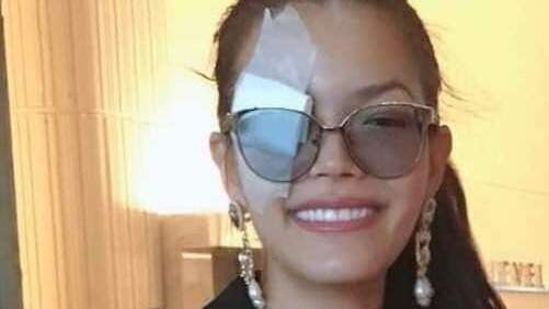 Miss Tailandia se lastima un ojo