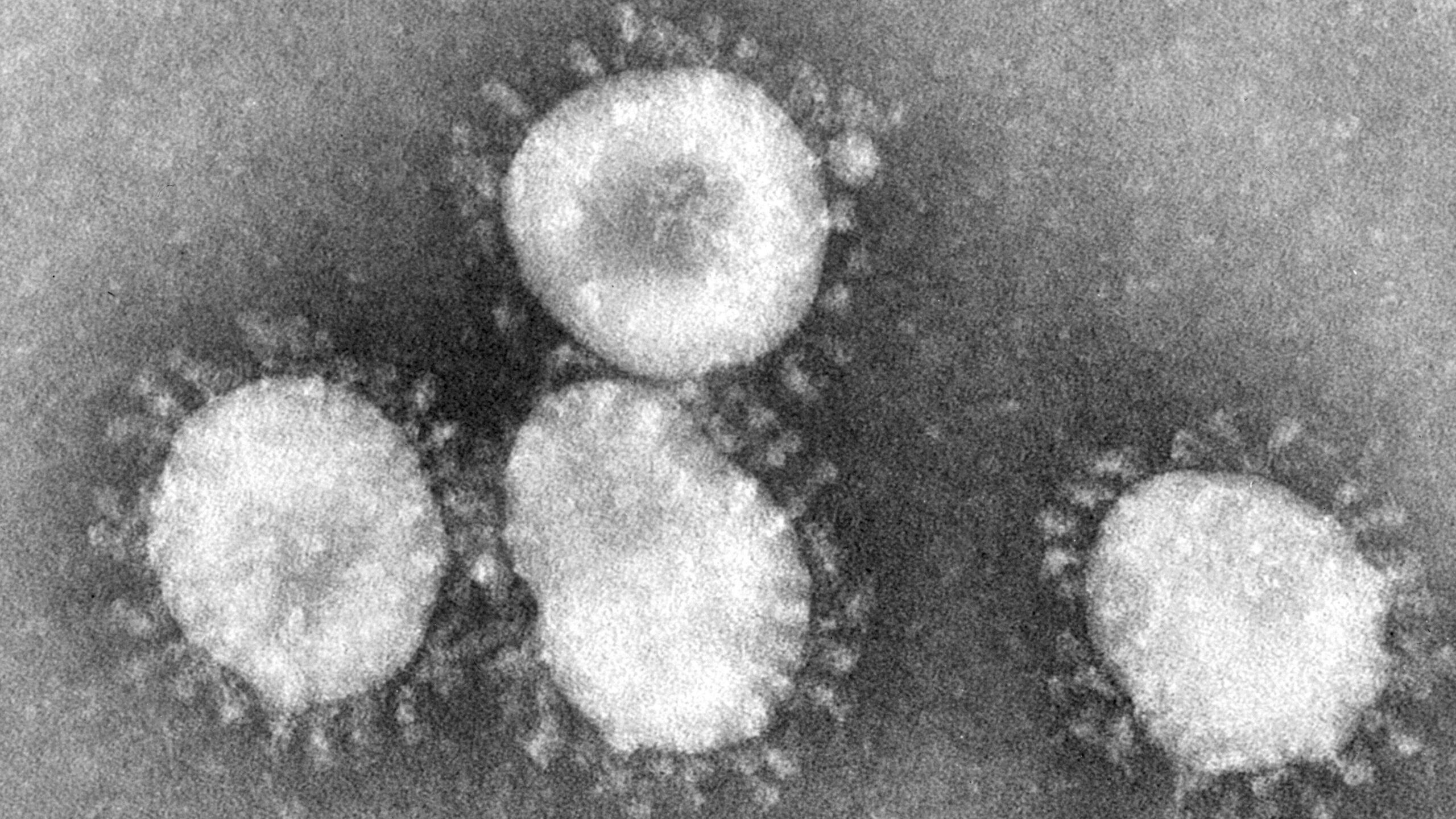 Se detecta el primer caso de coronavirus en Estados Unidos