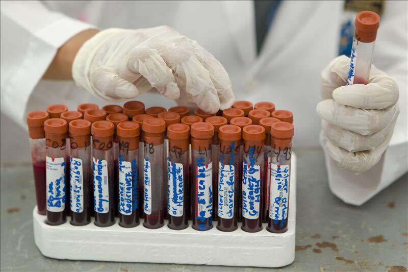 Laboratorios clínicos denuncian reducción de cubiertas en pruebas de laboratorio