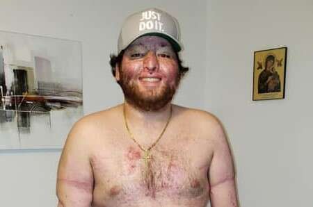 Condonan deuda a joven Alexis Joel Hernández