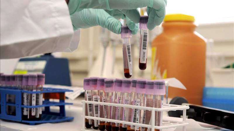 Laboratorios clínicos objetan aumento salarial propuesto para tecnólogos