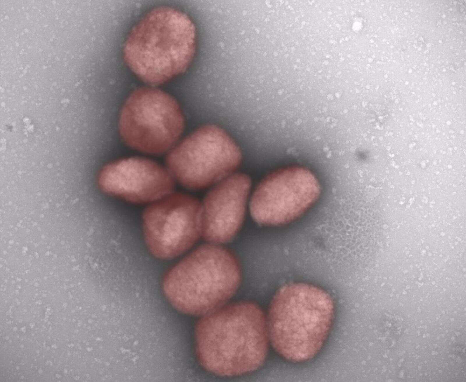 El virus de la viruela del mono podría transmitirse también por vía aérea