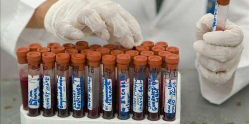 Laboratorios Clínicos condenan aprobación por descargue medida aumenta salarios tecnólogos