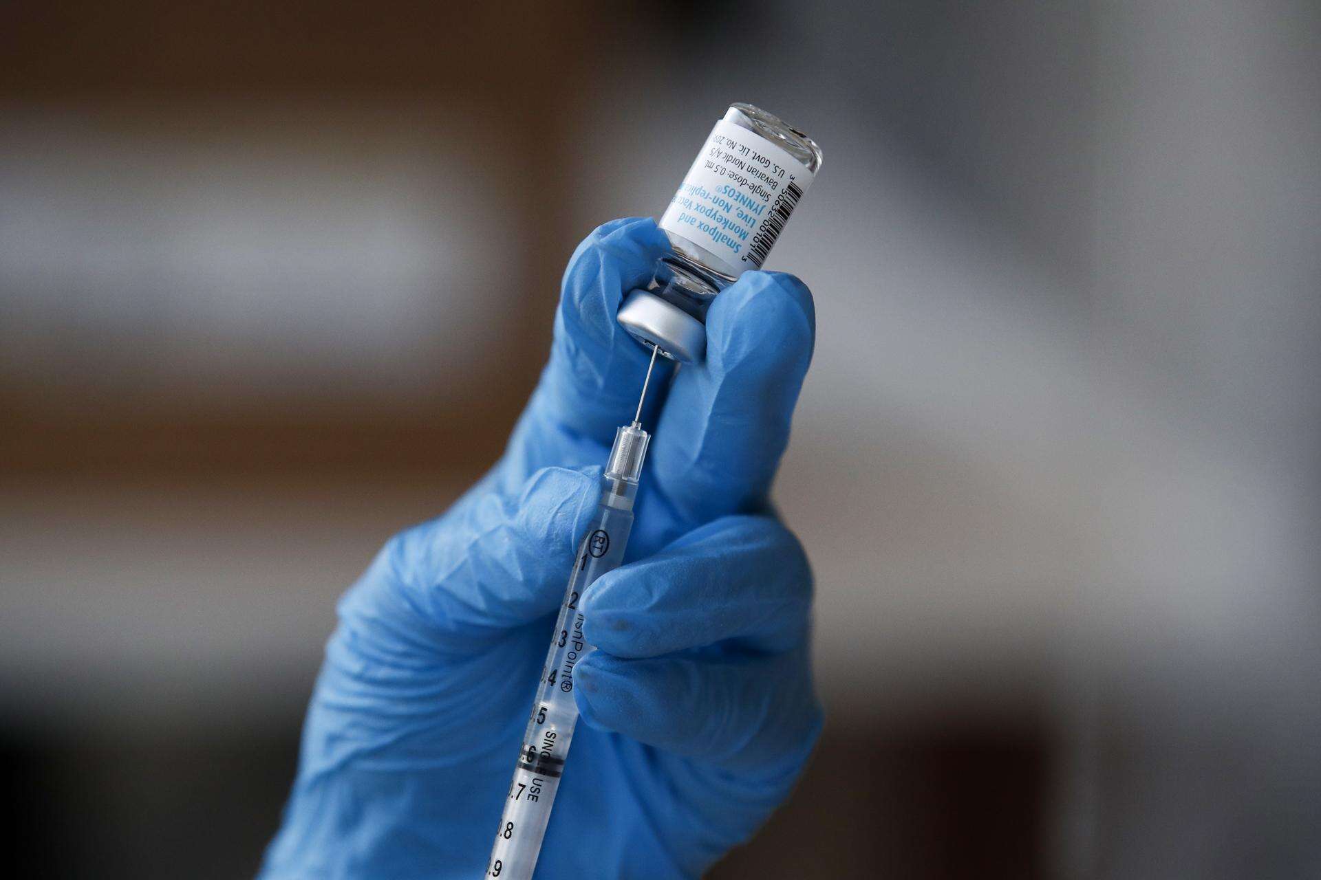 Salud hace hincapié en las medidas de prevención para reducir contagio de la viruela símica