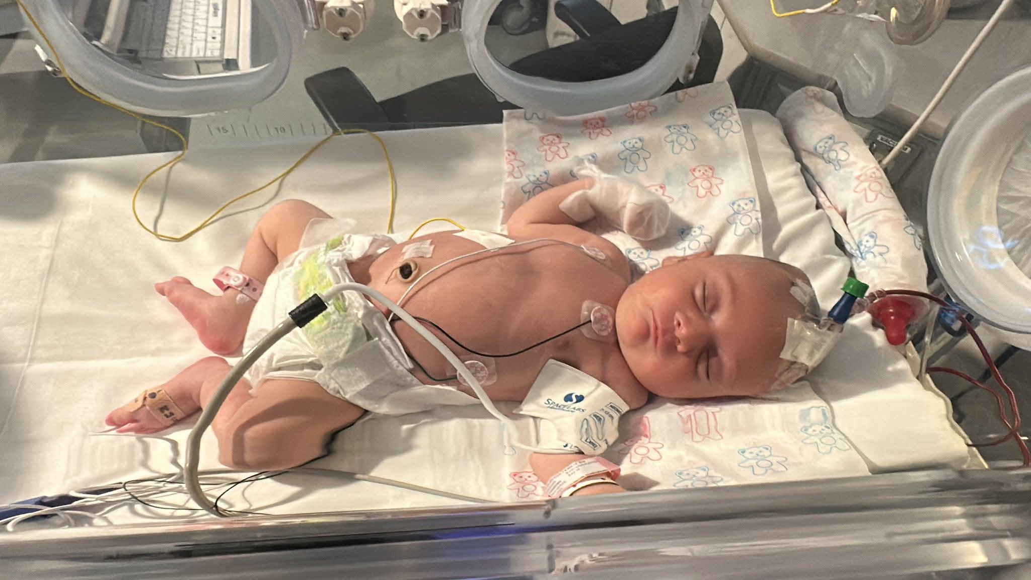 Con tan solo dos meses enfrenta diagnóstico de espina bífida y su familia necesita apoyo