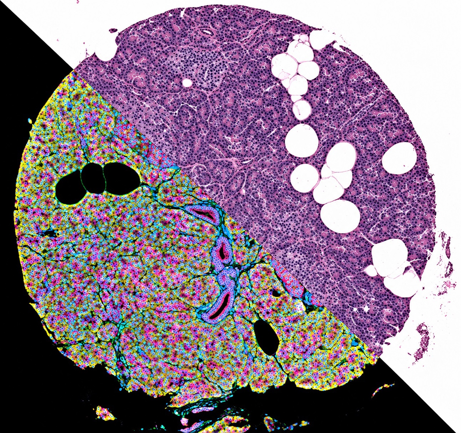 Spain: Scientists create first comprehensive cellular atlas of the human pancreas